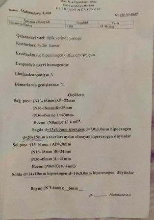 M. Topçubaşov adına elimi cərrahiyə mərkəzində biyabırçılıq.(siğorta olduğu təqdirdə xəstədən israrla pul tələb etdilər)