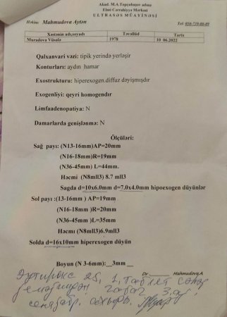 M. Topçubaşov adına elimi cərrahiyə mərkəzində biyabırçılıq.(siğorta olduğu təqdirdə xəstədən israrla pul tələb etdilər)